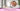 Perimenopause and Hair Loss: Understanding Hair Changes During Midlife